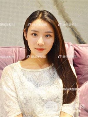 江蘇施爾美自體脂肪填充面部案例，前后對(duì)比圖分享