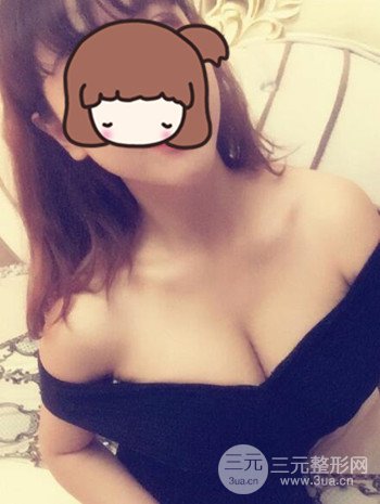 假體隆胸術后成功擺脫小學生身材，立現(xiàn)性感身材