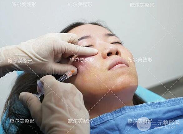 南京施爾美玻尿酸注射案例,讓蘋(píng)果肌嘭嘭嘭！
