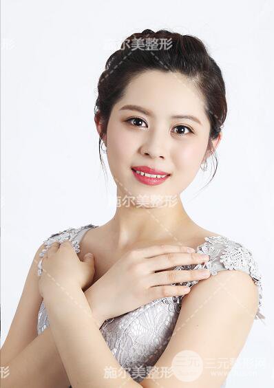 南京施爾美孫欣雙眼皮案例果恢復(fù)圖