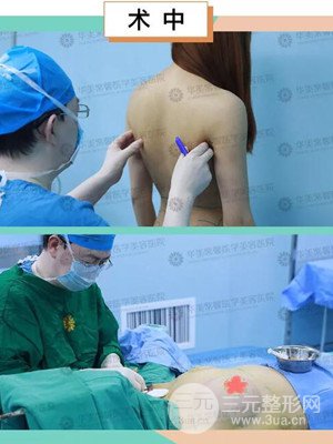 四川華美紫馨自體脂肪豐胸前后對(duì)比圖，術(shù)后果驚人!