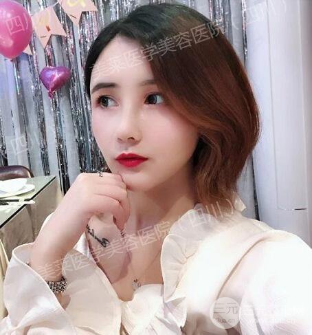 牛永敢醫(yī)生隆鼻案例術(shù)后恢復(fù)記錄詳情