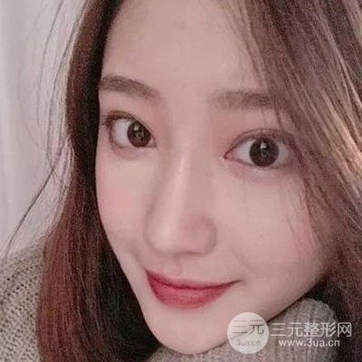 硅膠假體隆鼻案例前后對(duì)比圖分享！顏值變化驚人！