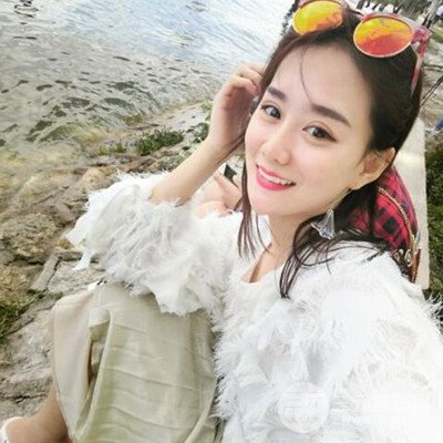 廣州韓妃李光琴隆鼻失敗修復(fù)前后對比圖分享！