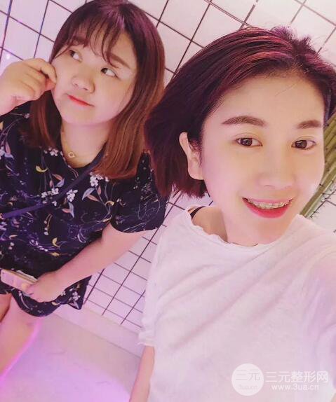 北京大學(xué)口腔醫(yī)院牙齒矯正案例詳情