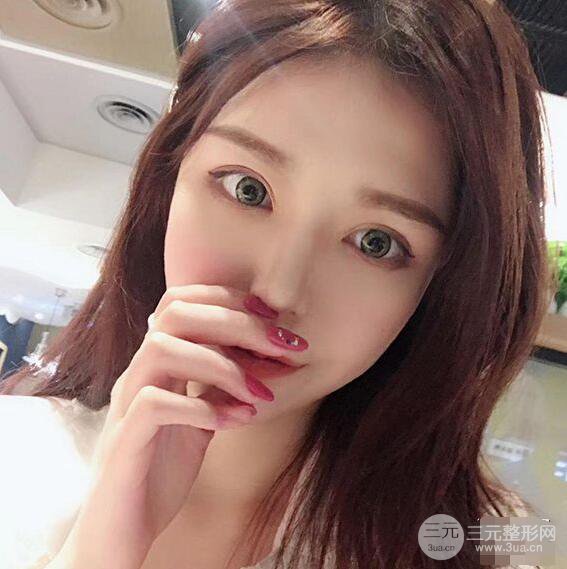 延吉金光善眼部整形失敗修復(fù)前后對(duì)比圖 三個(gè)月恢復(fù)自然