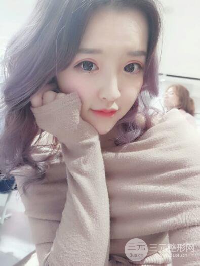 成都天使之翼張勁松切開雙眼皮案例前后對比圖心情小札