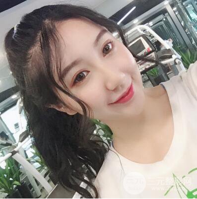 合肥壹加壹假體隆鼻果對比圖 45天恢復(fù)心路歷程