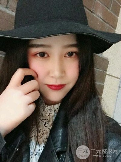 四川友誼李萍醫(yī)生假體墊下巴前后對(duì)比果圖片分享~