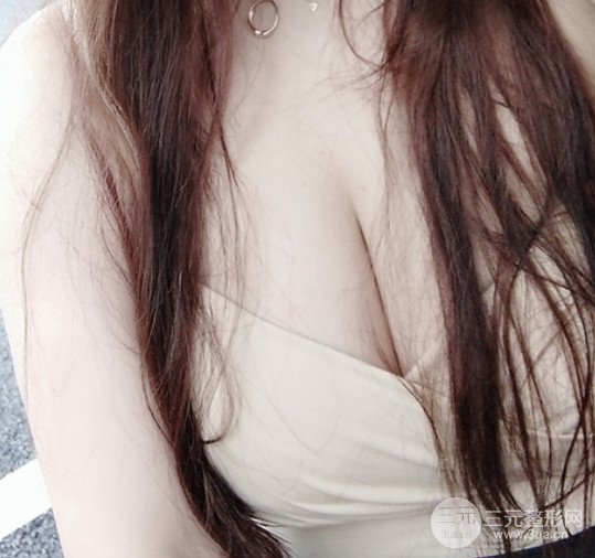 瑞美薈醫(yī)療美容診所薛瑞院長(zhǎng)假體隆胸豐胸案例展示果