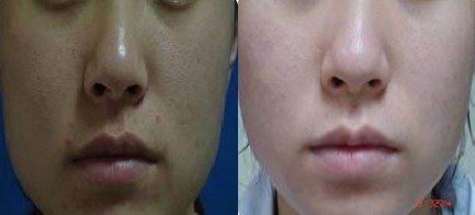 黑臉娃娃果對比圖