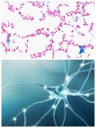 新型注射瘦臉被發(fā)現(xiàn)