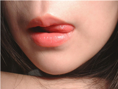 四川厚唇改薄術(shù)后多久能消腫