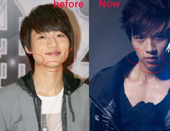 盤點娛樂圈三大男士下頜角整形的成功范例