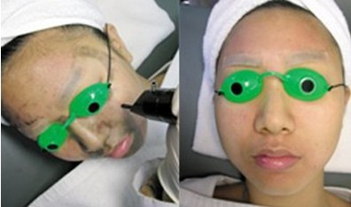 做黑臉娃娃美白果怎樣好不好 做黑臉娃娃美白果怎樣好嗎