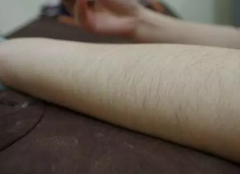 做腋下激光永.久脫毛大概一般多少錢價格 做冰點激光疼痛感較輕脫毛價格表多少錢