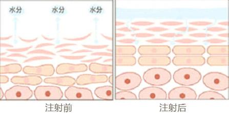 打水光補(bǔ)水價(jià)錢高的和價(jià)錢便宜的有什么區(qū)別呢
