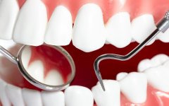 矯正牙齒一般需要多少錢