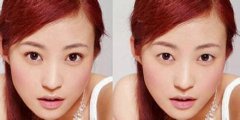 有沒(méi)有雙眼皮變單眼皮的方法 怎樣把雙眼皮變成單眼皮
