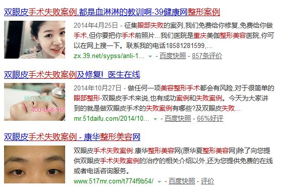 重慶眼部整形美容手術(shù)失敗修復(fù)多少錢