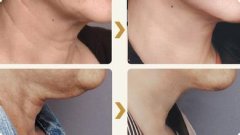 電波l皮的原理是什么呢