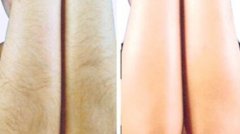 新疆到底什么方法脫腋毛好呢？