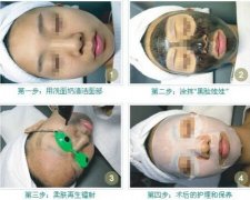 做黑臉娃娃果怎么樣