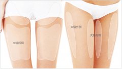 注射瘦腿的果如何 打注射瘦腿要注意哪些事項(xiàng)