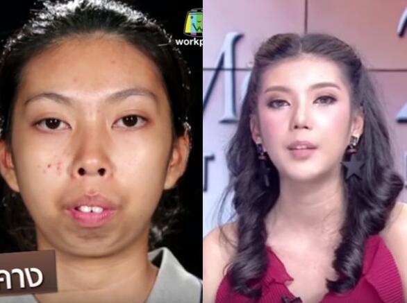 泰國,暴牙妹,整容,**,超出想象