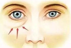 福州名韓注射除皺好嗎 價格表