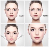 注射瘦臉注射美容前后對比果圖片