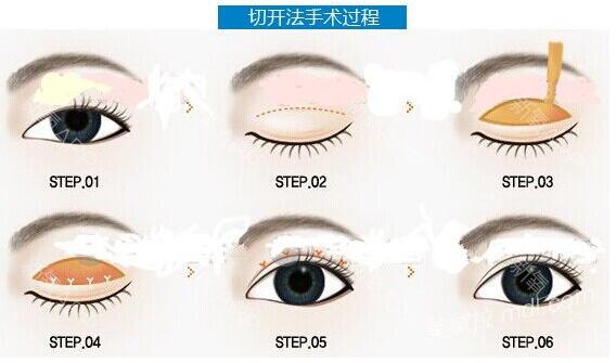 太原麗都整形醫(yī)院價(jià)格表新曝光一覽