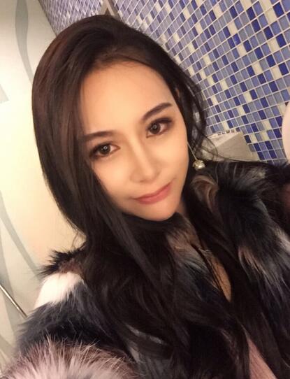 成都天使之翼做隆鼻整形改變了我的塌鼻子 果真的很不錯(cuò)