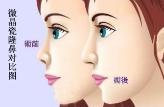 南昌佳美整形醫(yī)院價(jià)格表一覽爆出