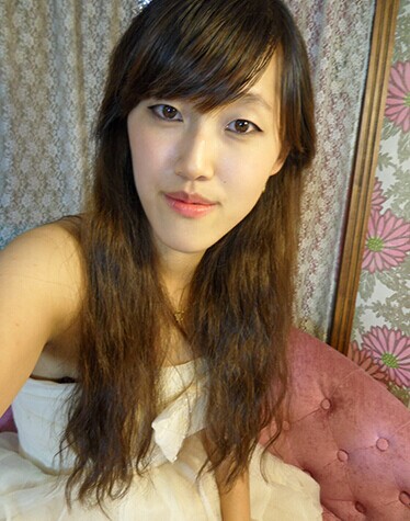 在北京藝星醫(yī)療美容醫(yī)院做下頜角整形手術真實經歷