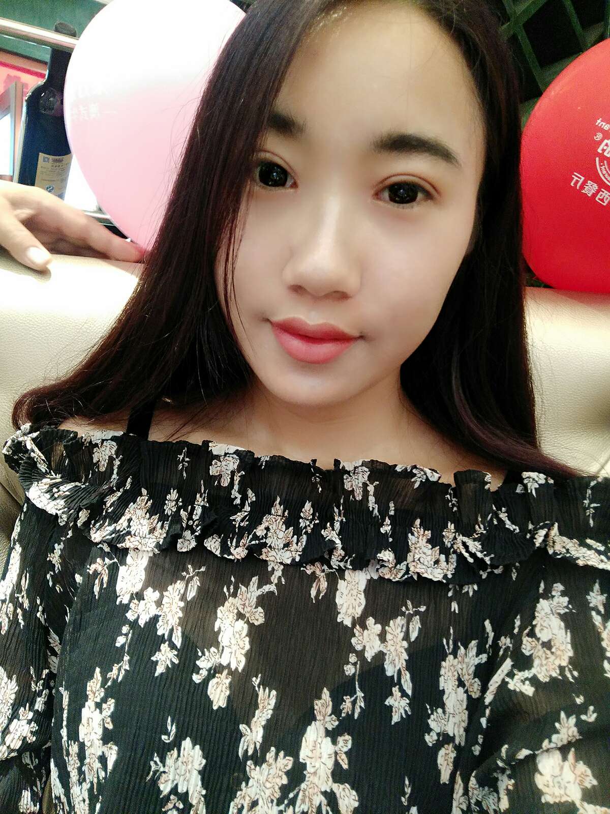 8.15號割的雙眼皮 感謝慕醫(yī)生