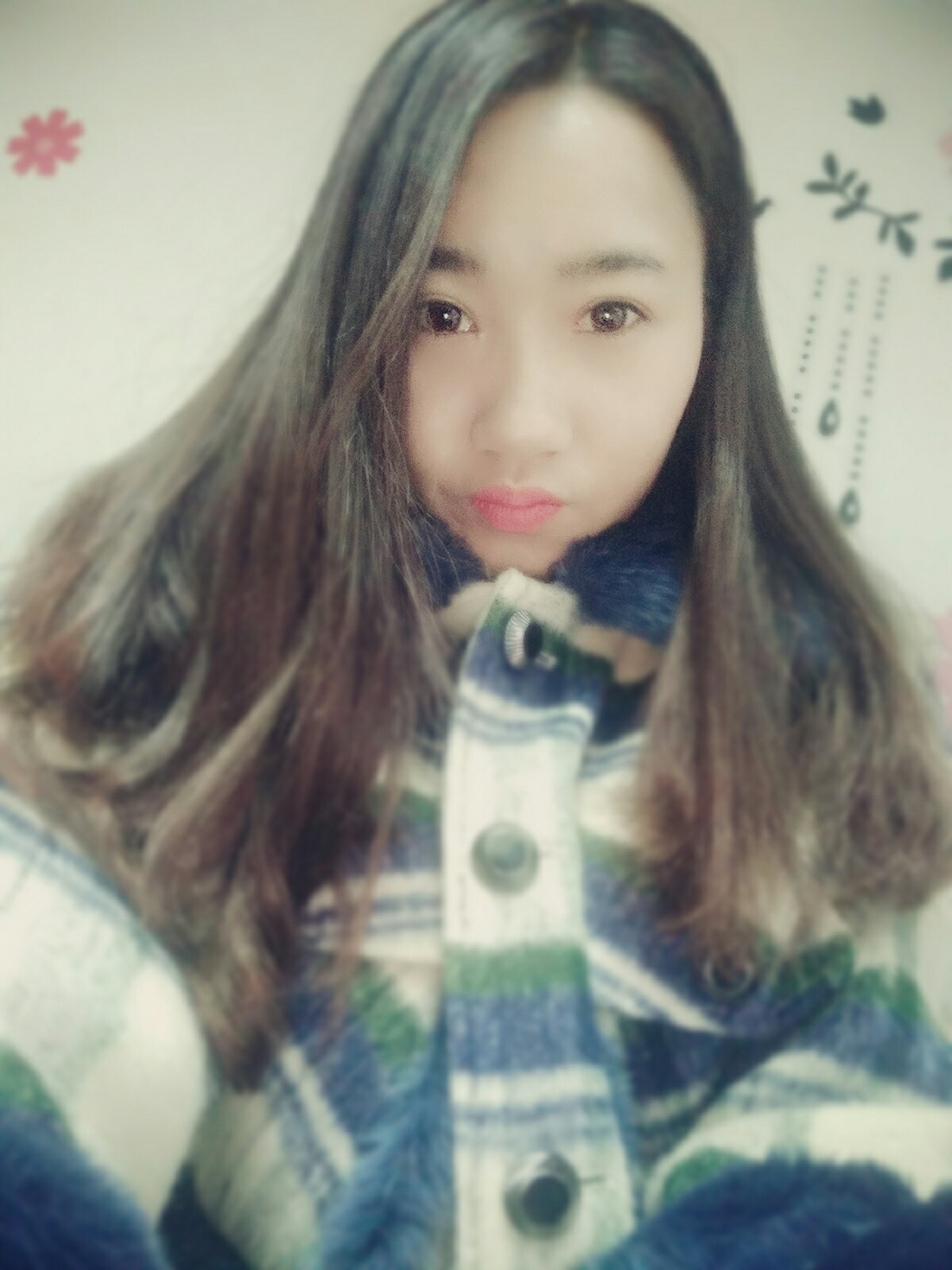 8.15號割的雙眼皮 感謝慕醫(yī)生