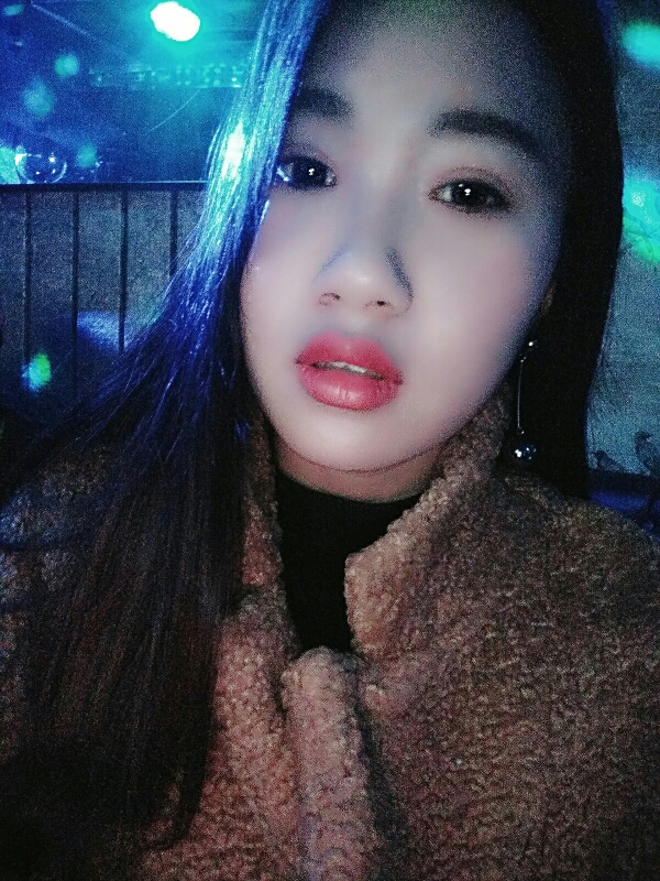 8.15號割的雙眼皮 感謝慕醫(yī)生