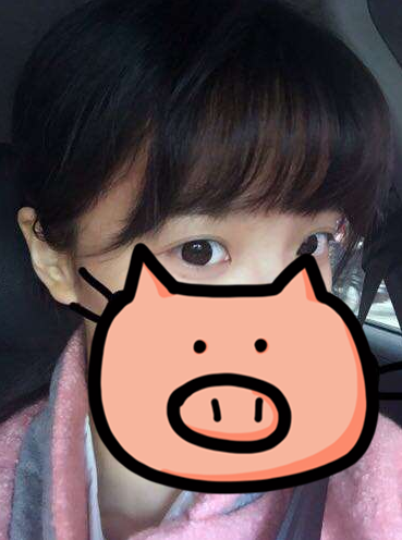 成都玉之光發(fā)際線種植 果不錯~