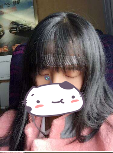 成都玉之光發(fā)際線種植 果不錯~