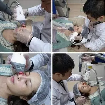 成都玉之光激光嫩膚經(jīng)歷 愛(ài)美的MM一定要看