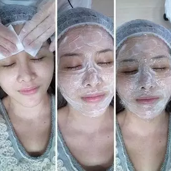 成都玉之光激光嫩膚經(jīng)歷 愛(ài)美的MM一定要看