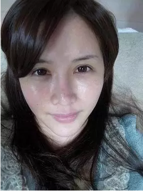 成都玉之光激光嫩膚經(jīng)歷 愛(ài)美的MM一定要看