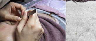 成都玉之光做了杏仁酸換膚 皮膚真的凈白無(wú)瑕了