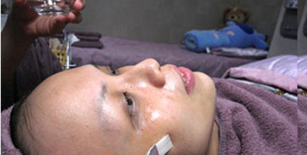 成都玉之光做了杏仁酸換膚 皮膚真的凈白無(wú)瑕了