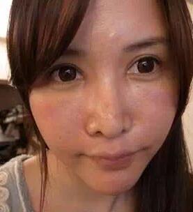 成都玉之光激光嫩膚經(jīng)歷 愛(ài)美的MM一定要看