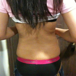 北京禾美嘉腹部吸脂 可以自信地秀出小蠻腰啦!