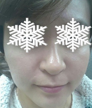 北京禾美嘉彩光嫩膚 果不錯哦~