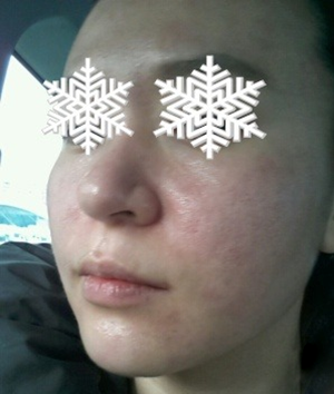 北京禾美嘉彩光嫩膚 果不錯哦~