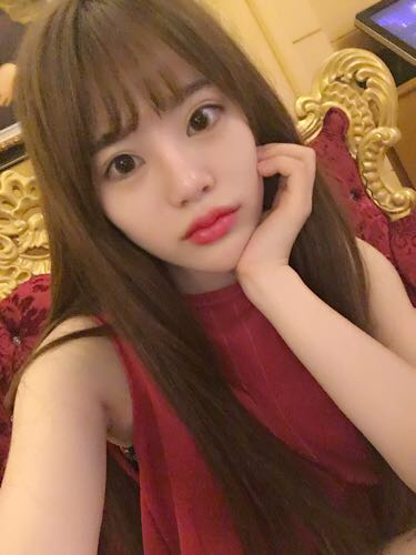 北京禾美嘉注射玻尿酸豐唇+豐臥蠶 讓我更美啦~